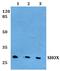 Short stature homeobox protein antibody, PA5-37220, Invitrogen Antibodies, Western Blot image 