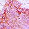 Probable G-protein coupled receptor 116 antibody, LS-C354382, Lifespan Biosciences, Immunohistochemistry paraffin image 