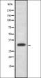 Zinc Finger Matrin-Type 3 antibody, orb337667, Biorbyt, Western Blot image 