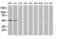 Protein kinase C and casein kinase substrate in neurons protein 3 antibody, LS-C172548, Lifespan Biosciences, Western Blot image 