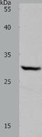 DT-diaphorase antibody, TA323406, Origene, Western Blot image 