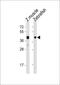 Alpha-2Db adrenergic receptor antibody, MBS9212775, MyBioSource, Western Blot image 