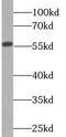 Cytochrome P450 Family 2 Subfamily D Member 6 antibody, FNab02158, FineTest, Western Blot image 
