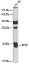SML1 antibody, 19-653, ProSci, Western Blot image 