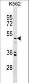 Uronyl 2-Sulfotransferase antibody, LS-C157336, Lifespan Biosciences, Western Blot image 