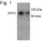 Solute Carrier Family 6 Member 3 antibody, PA1-4656, Invitrogen Antibodies, Western Blot image 