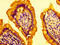 Autocrine Motility Factor Receptor antibody, CSB-PA333164LA01HU, Cusabio, Immunohistochemistry paraffin image 