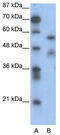 Nuclear Factor I A antibody, TA331120, Origene, Western Blot image 