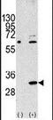 Eukaryotic Translation Initiation Factor 4E Family Member 2 antibody, PA5-11798, Invitrogen Antibodies, Western Blot image 