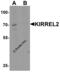 Kirre Like Nephrin Family Adhesion Molecule 2 antibody, 7971, ProSci, Western Blot image 