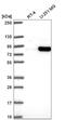 Histone H2A deubiquitinase MYSM1 antibody, NBP2-57859, Novus Biologicals, Western Blot image 