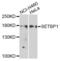 SET Binding Protein 1 antibody, LS-C346394, Lifespan Biosciences, Western Blot image 