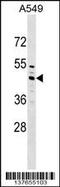 Zinc Finger CCCH-Type Containing 10 antibody, 59-328, ProSci, Western Blot image 