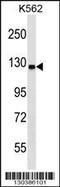 Ubiquitin Like Modifier Activating Enzyme 6 antibody, 58-782, ProSci, Western Blot image 