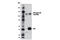RB Transcriptional Corepressor 1 antibody, 8147T, Cell Signaling Technology, Immunoprecipitation image 