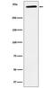 Lipoprotein(A) antibody, M00472, Boster Biological Technology, Western Blot image 