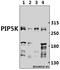 Phosphoinositide Kinase, FYVE-Type Zinc Finger Containing antibody, A02638, Boster Biological Technology, Western Blot image 
