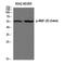 Myocyte Enhancer Factor 2D antibody, STJ90325, St John