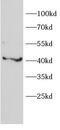 Alpha-1-B Glycoprotein antibody, FNab10349, FineTest, Western Blot image 