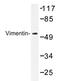 Vimentin antibody, AP20321PU-N, Origene, Western Blot image 