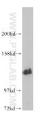 Serine/threonine-protein phosphatase 2A regulatory subunit B subunit alpha antibody, 14720-1-AP, Proteintech Group, Western Blot image 