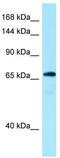 Protein MON2 homolog antibody, TA338068, Origene, Western Blot image 