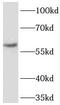 Transducin Beta Like 1 X-Linked Receptor 1 antibody, FNab08523, FineTest, Western Blot image 