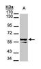 Cytokeratin 6 antibody, PA5-28235, Invitrogen Antibodies, Western Blot image 