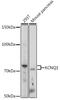 Potassium Voltage-Gated Channel Subfamily Q Member 1 antibody, GTX64507, GeneTex, Western Blot image 