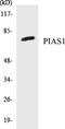 Protein Inhibitor Of Activated STAT 1 antibody, EKC1457, Boster Biological Technology, Western Blot image 