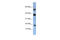 Ataxin 7 Like 1 antibody, 27-040, ProSci, Western Blot image 