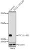 Mitochondrial fission 1 protein antibody, GTX55624, GeneTex, Western Blot image 