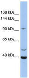 Leucine Rich Repeat Containing 37B antibody, TA342067, Origene, Western Blot image 