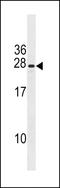 PIH1 Domain Containing 3 antibody, LS-C203779, Lifespan Biosciences, Western Blot image 