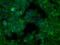Bruton Tyrosine Kinase antibody, M00245-2, Boster Biological Technology, Immunofluorescence image 