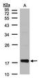 Cofilin 2 antibody, TA308342, Origene, Western Blot image 