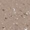 Inhibitor Of Growth Family Member 4 antibody, FNab04314, FineTest, Immunohistochemistry paraffin image 