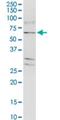 Tight Junction Associated Protein 1 antibody, H00093643-M01-100ug, Novus Biologicals, Western Blot image 