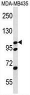 Catenin Delta 2 antibody, AP51127PU-N, Origene, Western Blot image 