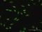 SATB Homeobox 1 antibody, H00006304-B01P, Novus Biologicals, Immunocytochemistry image 