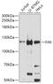 Protein Tyrosine Kinase 2 antibody, 13-952, ProSci, Western Blot image 