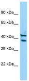 Serine/Threonine Kinase 35 antibody, TA334386, Origene, Western Blot image 