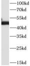 CD2 Molecule antibody, FNab01439, FineTest, Western Blot image 