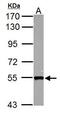 SET And MYND Domain Containing 1 antibody, GTX122067, GeneTex, Western Blot image 