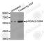 Histone Deacetylase 2 antibody, AP0201, ABclonal Technology, Western Blot image 