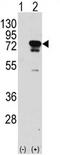 Eukaryotic translation initiation factor 4B antibody, AP11772PU-N, Origene, Western Blot image 