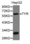Tyrosinase antibody, TA327028, Origene, Western Blot image 