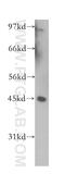 Nuclear Receptor Coactivator 3 antibody, 12705-1-AP, Proteintech Group, Western Blot image 
