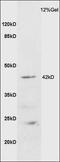 Galanin Receptor 2 antibody, orb157035, Biorbyt, Western Blot image 