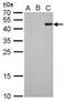 RFP antibody, NBP2-43580, Novus Biologicals, Western Blot image 